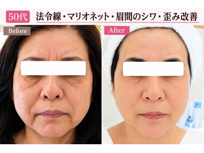 サロンドエステケイワイ(de KY)の写真