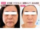 サロンドエステケイワイ(de KY)の写真