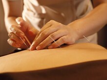 カモミール/鍼灸は適用範囲が広い！