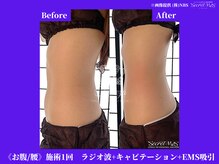 フェレザ 新潟(Felleza)/美ボディーを目指しましょう！