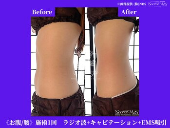 フェレザ 新潟(Felleza)/美ボディーを目指しましょう！