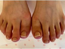 ビサンテ サロン/爪の悩みを解消できるNail Salon