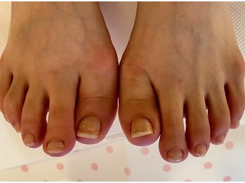 ビサンテ サロン/爪の悩みを解消できるNail Salon