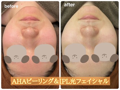 エステ イン アンヌドゥールの写真