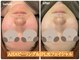 エステ イン アンヌドゥールの写真
