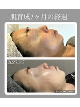 サイ(Sai)/肌育成