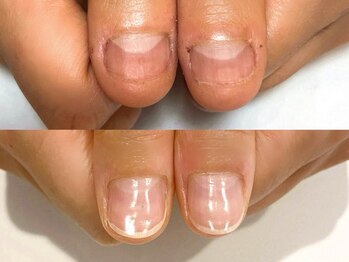 キラネイル アンド アイラッシュ by World Beauty(KIRA)の写真/驚きの長持ち！高技術で爪お悩み解決サロン。