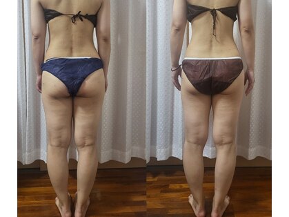 シャルム(Charme)の写真