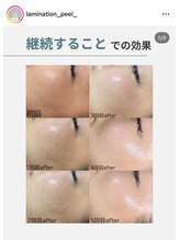 メイクス(Makes)/Lamination peel