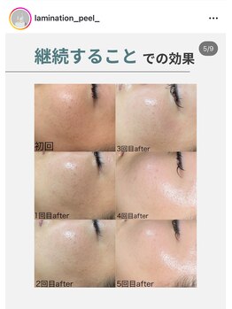 メイクス(Makes)/Lamination peel