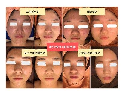 ベベ もりの里店(Be'be')の写真