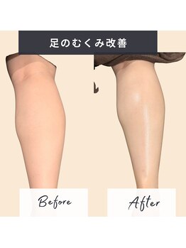 ソロウノ 平和島本院/足のむくみ改善