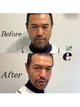 エクロム(eclomme)