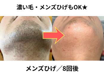 NTエステティック 西条店/