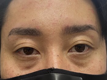 メンズビューティーカフェザパーム 大阪梅田(MEN'S BEAUTY CAFE×THE PERM)/メンズ眉毛Wax＆眉毛パーマ