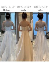 コルミチョン サロン(骨美整 salon)/ブライダル施術　Before・After