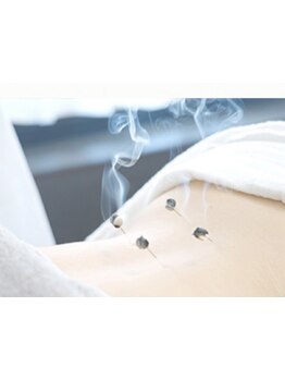 鍼灸施術を受けたい