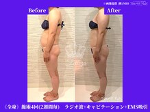 フェレザ 新潟(Felleza)/1回目から効果も♪※個人差あり