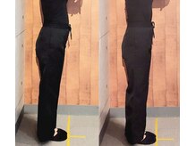 バランス整体 リスタート(Restart)/骨盤矯正でお腹も反り腰も改善