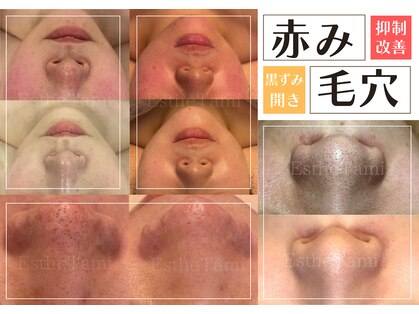 エステ ラミ(Esthe' l'ami)の写真