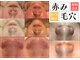 エステ ラミ(Esthe' l'ami)の写真