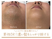 るあんの雰囲気（【男性も利用可能なメンズ脱毛】髭のないツヤ肌で清潔感アップ♪）