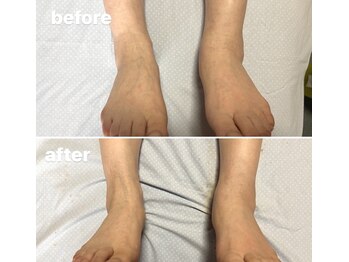 イールーム(eroom)/温熱リンパケアはむくみにも◎