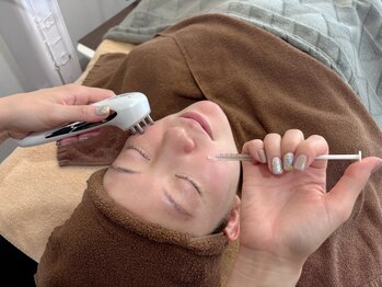 デューン 蕨店(Dune)の写真/口コミ5.0★リピ率◎【毛穴洗浄+幹細胞ハーブピーリング】SETの相乗効果でより毛穴レス肌へ!いちご鼻にも◎