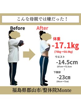 整体院 モンテ(monte)/before＆after