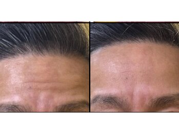 サロンモコ(Salon Moco)/