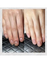 サロンドエヌ(Salon de N)/凹凸もお任せください