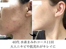 ヨサパーク タキ 上野毛(YOSA PARK TAKI)/40代・水素吸引