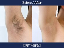 ランドマーク 中崎町(LANDMARK.)/《 ワキ 》