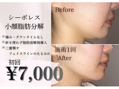 ミア(miiia)の写真