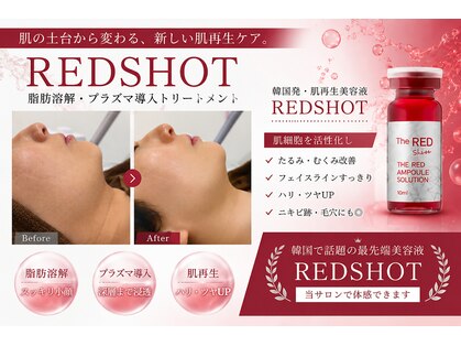 アンフィア(Anfia)の写真