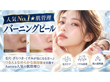 オーロラ(Aurora)の写真