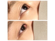 ビオス アイラッシュ 五反田(Bios eyelash)/下ラッシュリフト