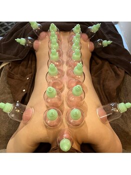 ソルーナ(So-Luna)/カッピング