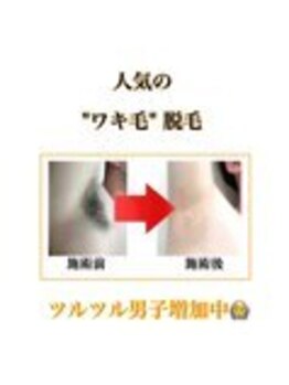 メンズ脱毛ダイアナ 松江店/人気のワキ脱毛