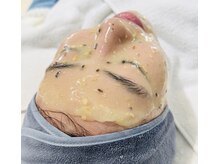 ライカブルー(RaicA BluE)/ハイドロジェリーマスク(10)