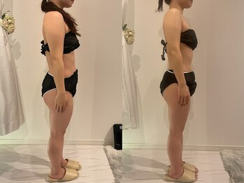 サロンリーナ 銀座店(SalonLena)/痩身(2ヶ月半)右側面