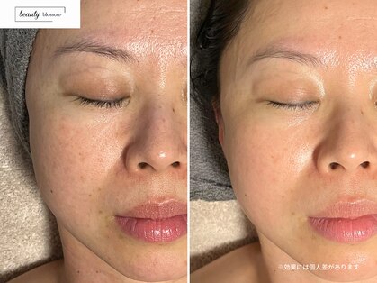 ビューティー ブロッサム(Beauty Blossom)の写真