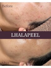 フォルディオ(FORDIO)/ララピール[札幌/円山]