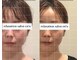 エヌ(en'u)の写真