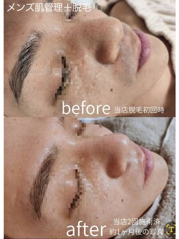 メンズにオススメのサロン