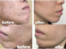 エイチズ(H's)の雰囲気（眉毛×肌ケアで近距離でも自信がもてる！清潔感ある印象に！）