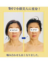 ビューティートワブルームサロン(Beauty Towabloom Salon)/深頭筋ヘッドリフトで小顔に変身
