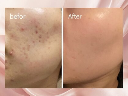 ファシル(Facile)の写真