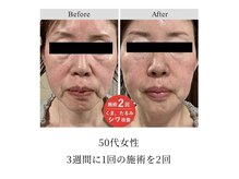 サロン ド グレース(Salon de Grace)の雰囲気（ヒト幹細胞培養上清液でエイジングケア。たるみ、しみケア）