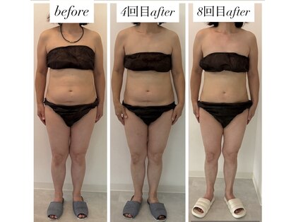 ファースト(First.)の写真